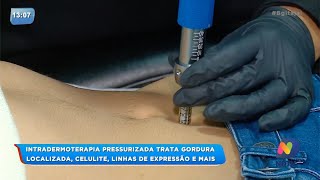 BG  Intradermoterapia pressurizada trata gordura localizada [upl. by Levania]