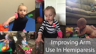 Improving Arm Use In Hemiparesis [upl. by Skye]