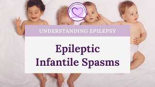 Signs of Infantile Spasms [upl. by Nnayar]