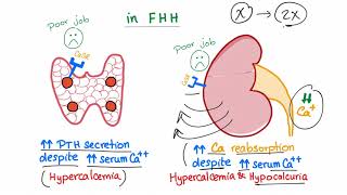 Familial Hypocalcuric Hypercalcemia FHH  Endocrinology and Nephrology [upl. by Ades289]