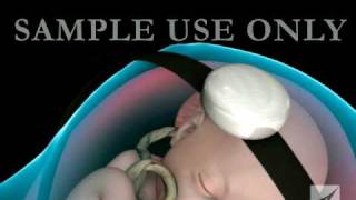 7 WEEKS FETAL DOPPLER BABYS HEARTBEAT [upl. by Calhoun]