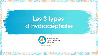 Hydrocéphalie  valve de dérivation peritonéale [upl. by Ahteres]