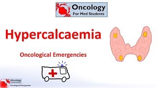 Hypercalcaemia of malignancy [upl. by Turpin]