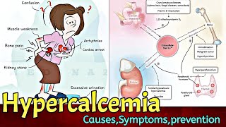 Hypercalcemia  കാൽസ്യത്തിൻറെ അളവ് കൂടാതെ തടയാം Causes Symptoms Prevention  Dr Medicosis [upl. by Hilaire423]