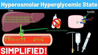 Hyperosmolar Hyperglycemic Nonketotic Syndrome  Panmedicad [upl. by Buchalter]