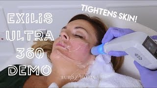 EXILIS ULTRA DEMONSTRATION FACE  Exilis Ultra 360 Experience at EuroPhoria [upl. by Asatan]