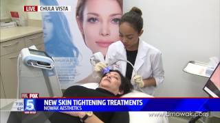 New Skin Tightening Treatment Exilis Ultra Face [upl. by Phiona]