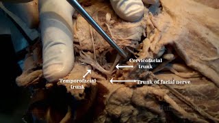 Parotid Gland II  Structures within [upl. by Kendy]