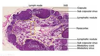 Update amp Neulasta OnBody Injector  My Journey With Leiomyosarcoma 18 [upl. by Oznole424]