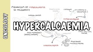 Hypercalcemia in malignancy  causes pathophysiology symptoms treatment [upl. by Pinebrook]