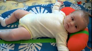 Infantile Spasms  seizures [upl. by Gilmore]