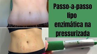 Lipo enzimática na pressurizada  Caneta pressurizada Mesodoctor X [upl. by Neelahtak]