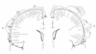 Difference Between Aphasia and Dysarthria [upl. by Brost]