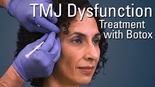 TMJ Dysfunction Treatment with Botox®  Sneak Preview [upl. by Terena642]