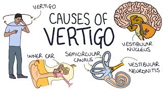 Labyrinthitis and Vertigo BPPV Hazels story  NHS [upl. by Nored]