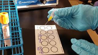 Microbiology Rapid Plasma Reagin RPR Test [upl. by Landel628]