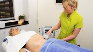 NonSurgical Liposuction and Body Contouring  Exilis Elite  Award Winning Treatment [upl. by Edny]