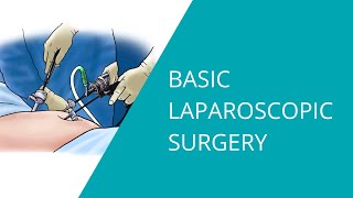 Basic Laparoscopic Surgery [upl. by Arihaz209]