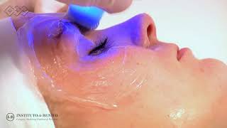 Exilis Ultra 360º  Aparatologia Facial [upl. by Marvel771]