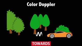 Ultrasound Physics Scanning Modes Color Doppler [upl. by Nylanej]